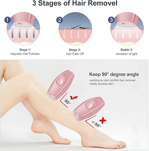 IPL Laser Hair Removal Handset