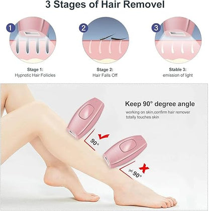 IPL Laser Hair Removal Handset